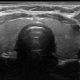 Small Parts and Musculoskeletal Ultrasound